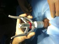 Durable Disposable Circumcision Stapler , Multipurpose Adult Circumcision Device